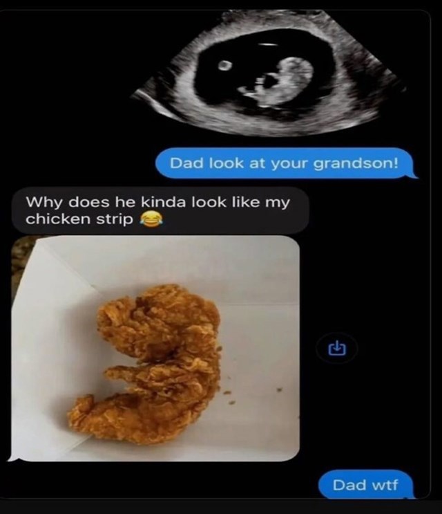 Poslala mu sliku ultrazvuka, tata kaže da izgleda kao njegov nugget