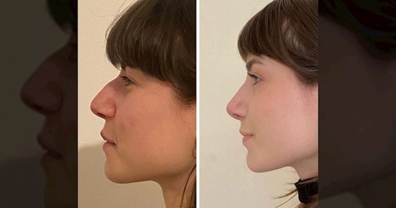 Ovih 17 žena odlučilo je drastično promijeniti izgled. Pogledajte fotke prije i poslije