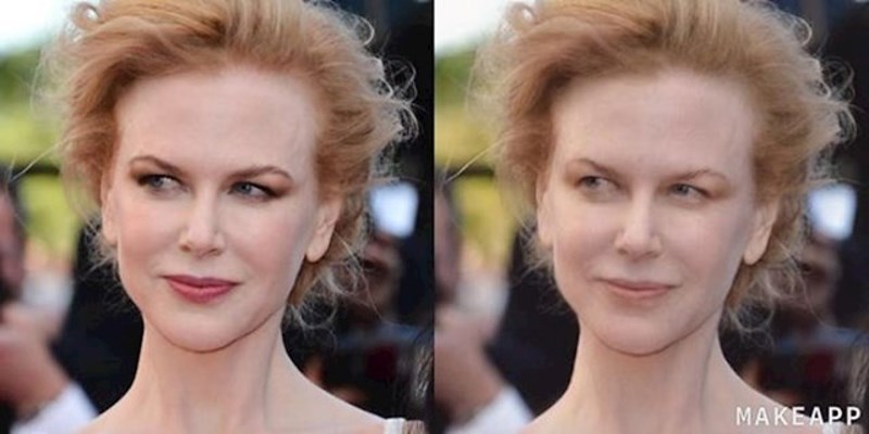 Nicole Kidman