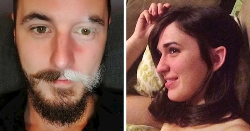 17 ljudi koji zbog neobičnih detalja na svom tijelu izgledaju unikatno