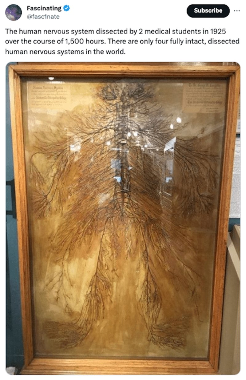 Ljudski nervni sustav. Dvojici studenata trebalo je 1500 sati da naprave ovo