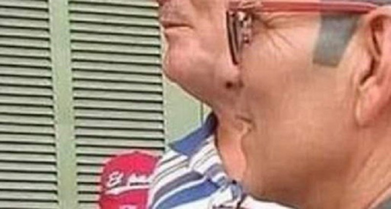 Morate vidjeti "kosu" ovog lika, ovo je jezivo