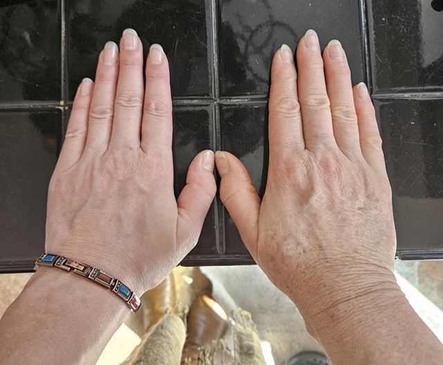 Mama i ja imamo identične ruke