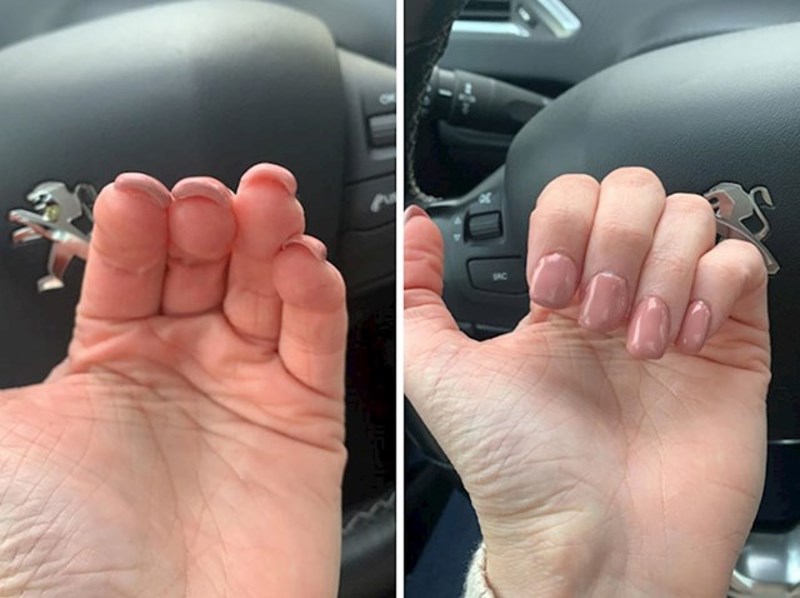 Najdeblji nokti na svijetu