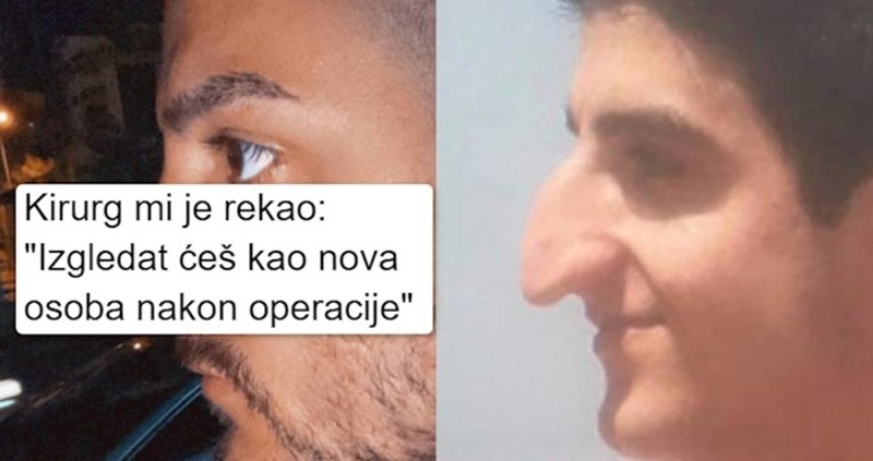 15 ljudi kojima je estetski zahvat potpuno promijenio izgled i život