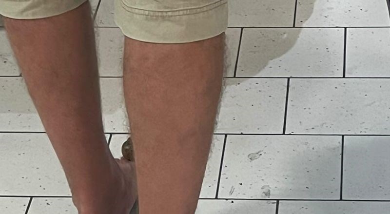 U trgovini u Dalmaciji zatekao je tipa s najluđom obućom ovog ljeta, ljudima nije jasno kako hoda