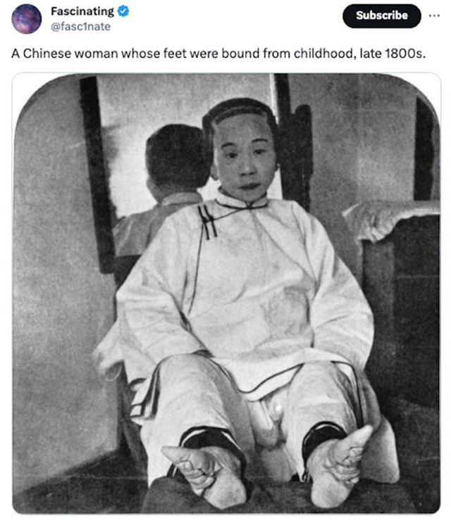 Kineskinja kojoj su vezali noge od rođenja