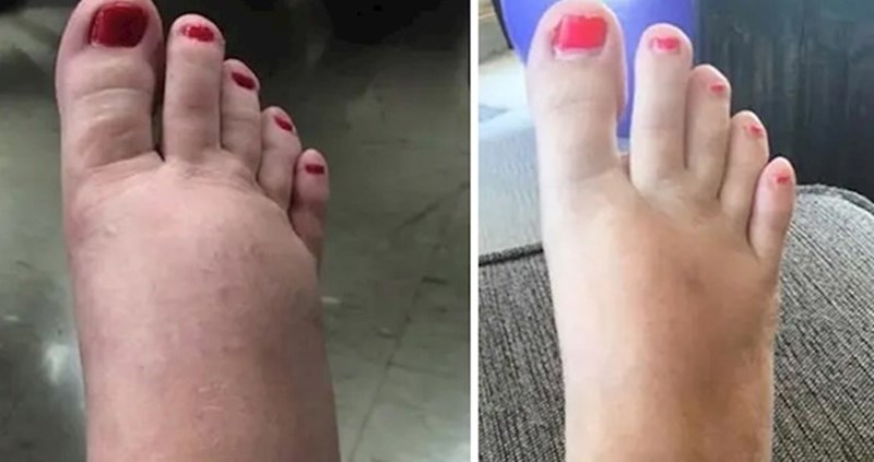 10 promjena kroz koje nažalost prolaze gotovo sve žene tijekom trudnoće