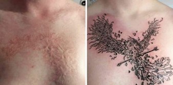 Ovaj tattoo majstor ožiljke pretvara u prekrasne tetovaže, odabrali smo 20 najboljih primjera