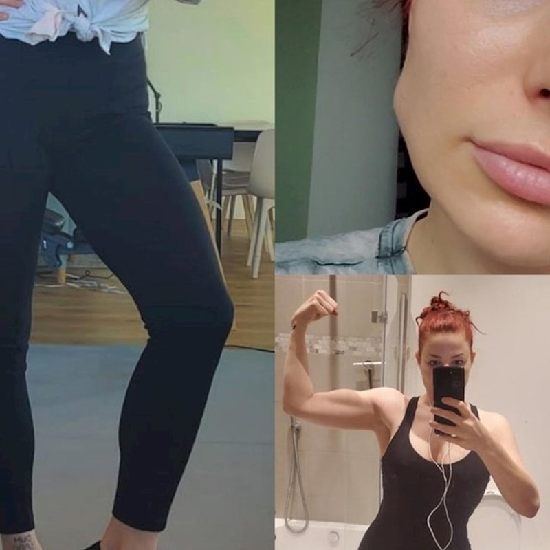 Ima genetski poremećaj zbog kojeg joj mišići rastu i bez vježbanja