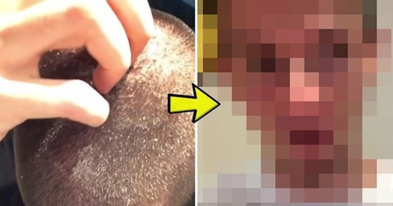 Dvije godine nije koristio šampon, pokazao je kako mu je kosa nakon toga izgledala