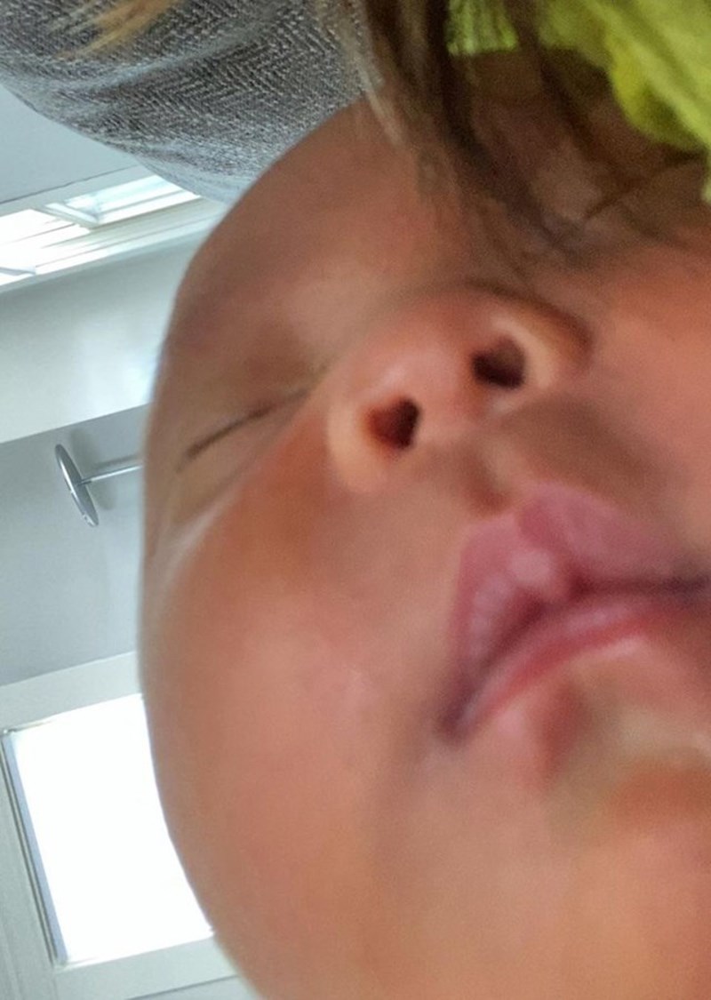 Ima nosnice u obliku srca