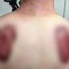Tip je poželio tetovirati krila na leđima, teško je riječima opisati ono što je dobio