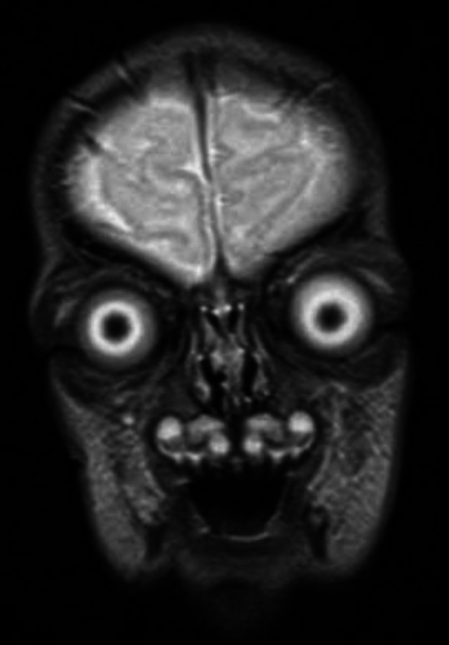 MRI snimka bebe