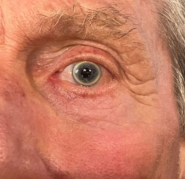 Moj djed ima najneobičnije oči