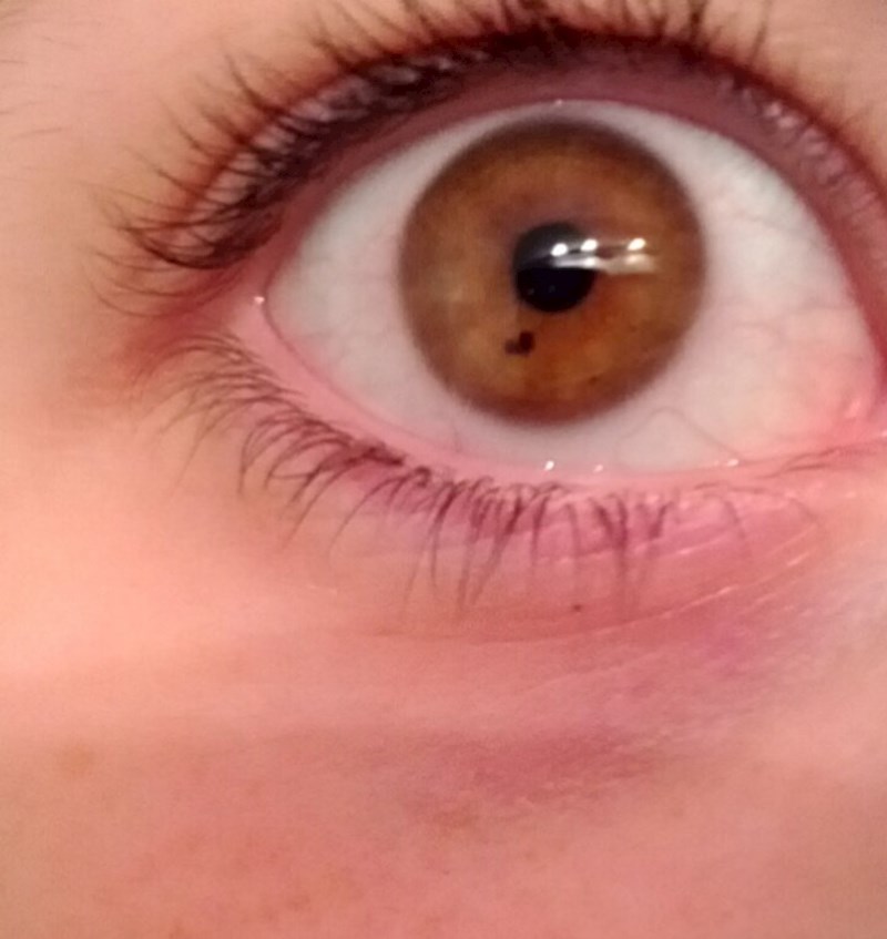 Imam točkicu u obliku srca na šarenici