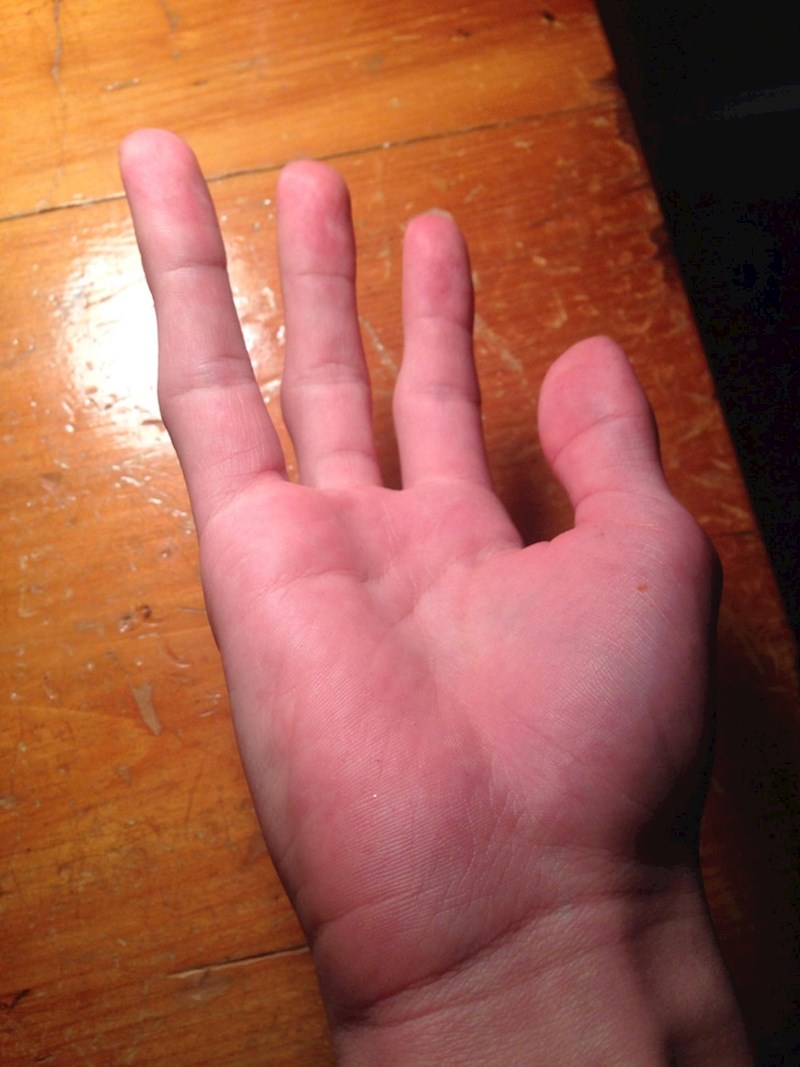 Bitno da je zaručnički prst tu!