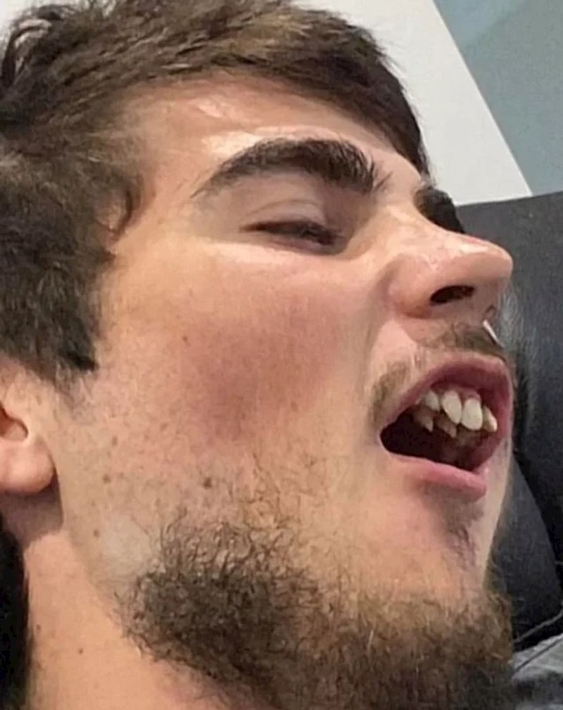 Tip ima dva reda trajnih zubi!