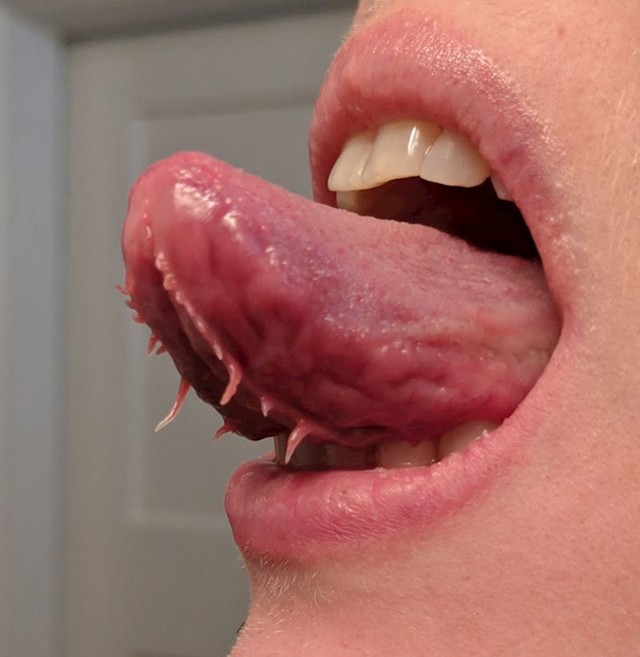 8.