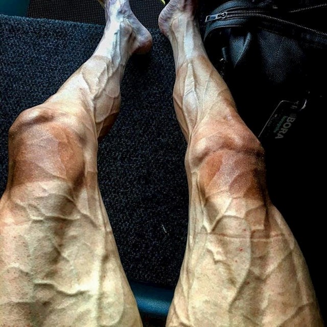 Noge Pawela Poljaskog nakon završetka 16 napornih etapa Tour de Francea