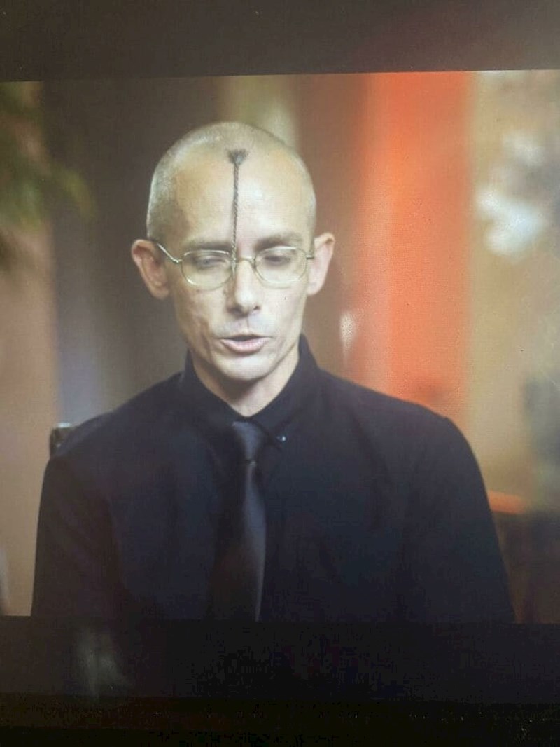 9. Navikli smo ovo viđati na stražnjoj strani glave, a i tako je već bilo dovoljno loše...