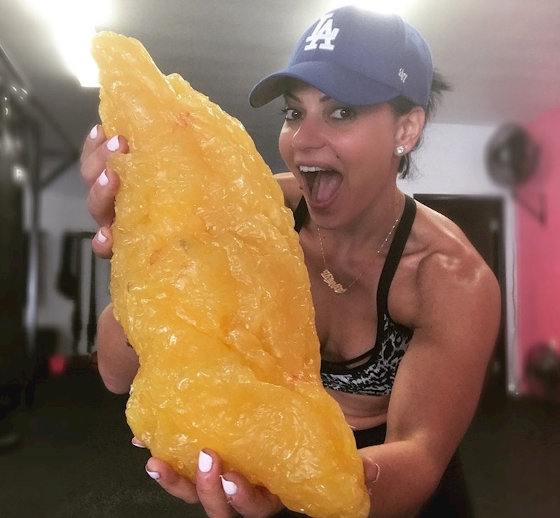 Da, to je masno tkivo u njenim rukama