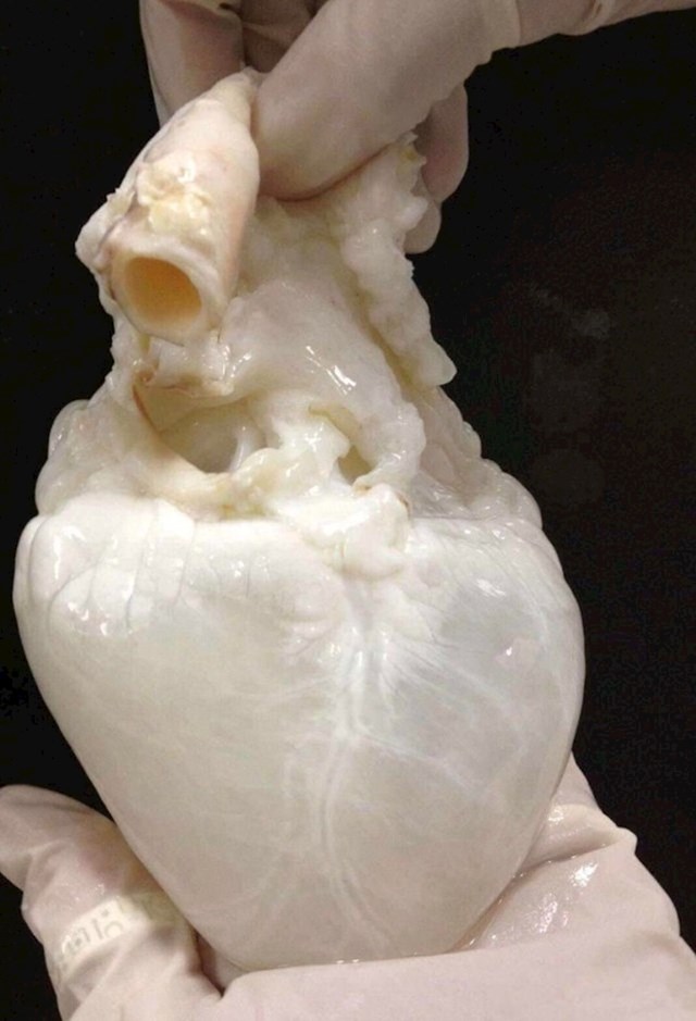 Ovako izgleda srce bez krvi