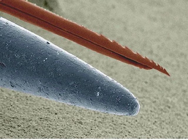 Žalac pčele i vrh igle promatrani ispod mikroskopa
