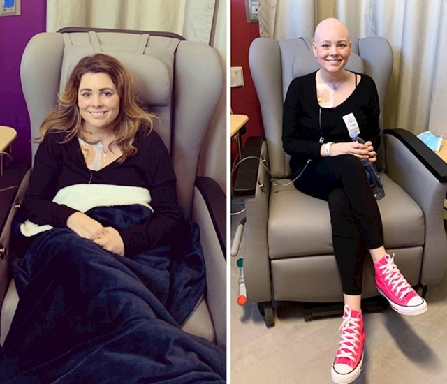 Prvi i zadnji dan kemoterapije