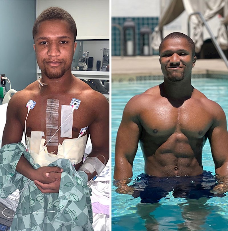 Dvije godine nakon operacije srca