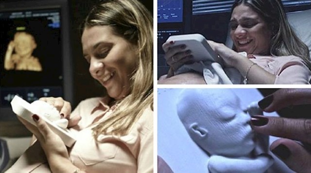 3D nalaz ultrazvuka za slijepu trudnicu