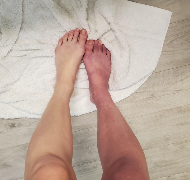 Imam dvije potpuno različite noge!