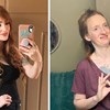 16 žena sprda se s nerealno savršenim Instagram objavama serijom neobičnih "prije i poslije" fotki