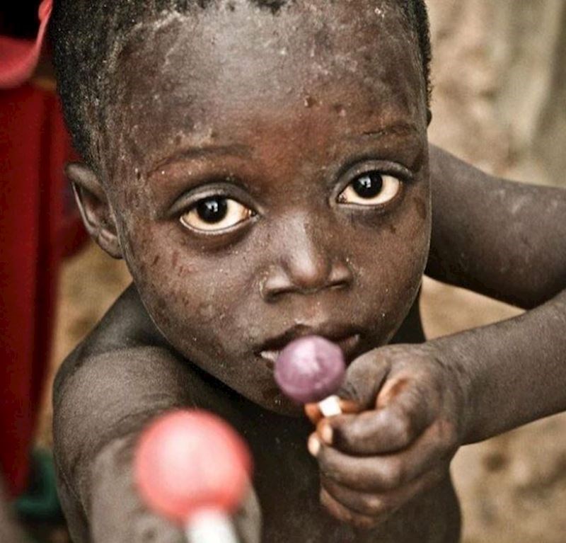 Gladno dijete pruža lizalicu fotografu jer ima dvije...