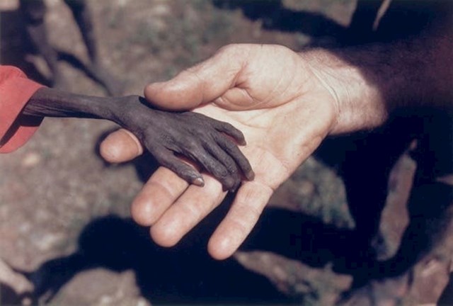 Pomoć je konačno stigla- ruka gladnog djeteta iz Ugande u ruci volontera!