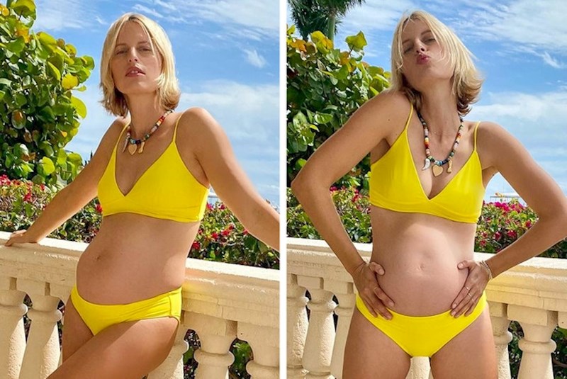 Poznati model Karolina Kurkova i njezin nepostojeći pupak