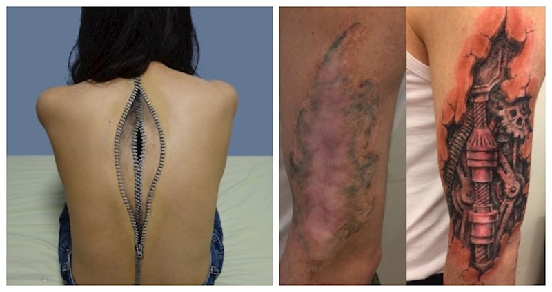 11 puta kada su tattoo majstori pretvorili ožiljke u umjetnost; sada ih vlasnici ponosno pokazuju!