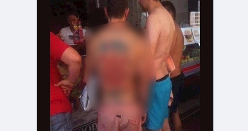 Fejsom kruži fotka najvećeg "domoljuba" ikad; ovakvu tetovažu još niste vidjeli