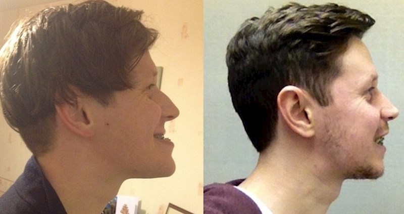 18 ljudi podvrglo se plastičnim operacijama i jedino za čim žale je što to nisu napravili ranije!