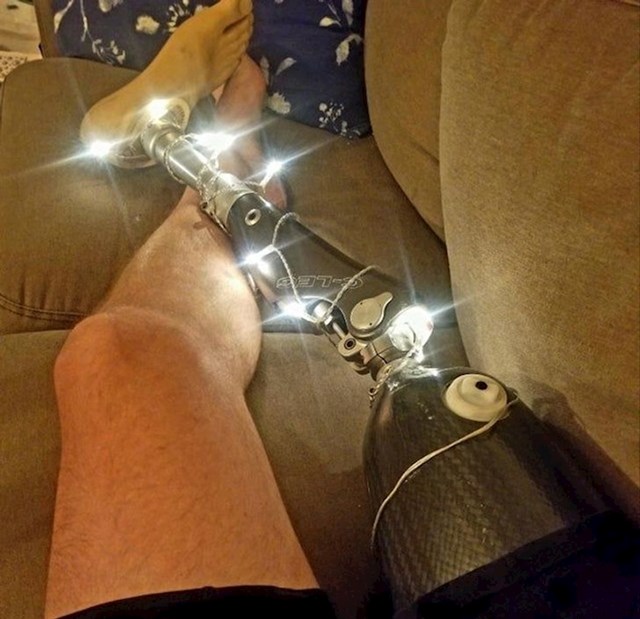 "Brat je smatrao da mi fali božićnog duha pa mi je okitio umjetnu nogu"