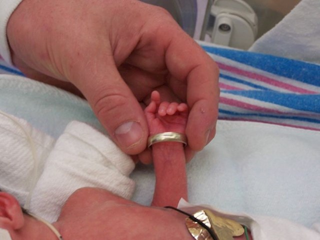 "Naša palčica rođena u 26 tjednu trudnoće imala je toliko malene ručice da joj je mužev vjenčani prsten bio preširok"