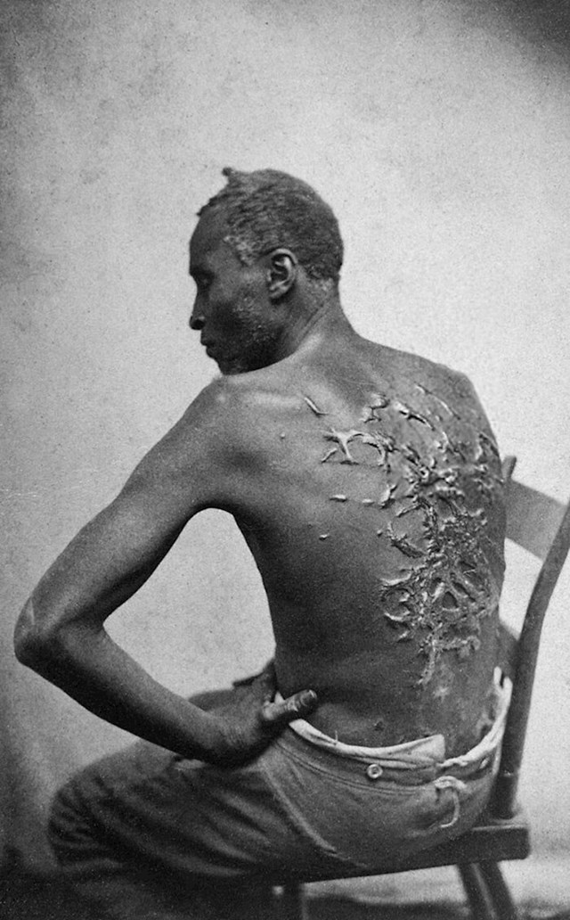 Odbjegli rob Peter pokazuje ožiljke na leđima uzrokovane bičevanjem. Uspio je pobjeći pola godine poslije, 1863.