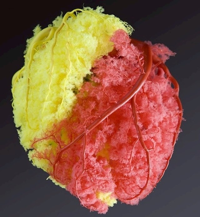Krvne žile srca napravljene u gipsu