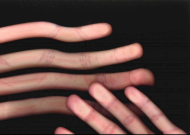 Ovako izgleda skenirana ruka u pokretu