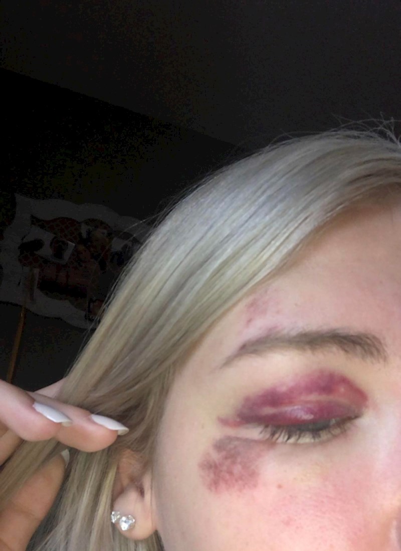 "Pala sam u nesvijest odjednom. Naravno da ispod mene nije bio krevet ili nešto mekano..."