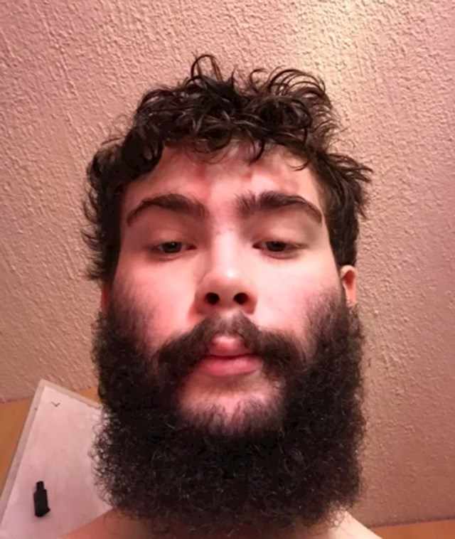 Imam 17 godina i ovako izgledam kada pustim bradu