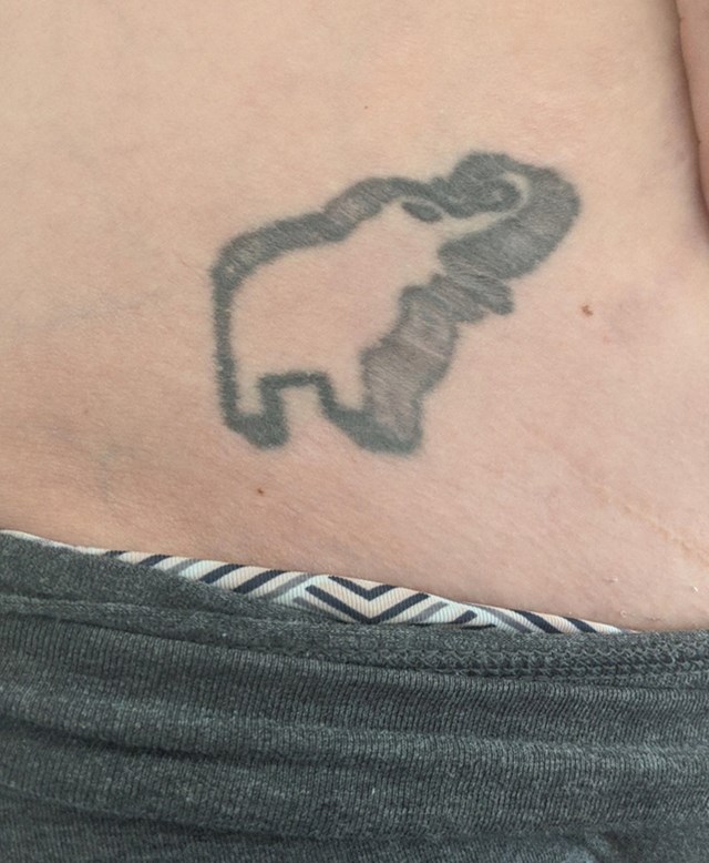 "Rub tetovaže se rastegao u trudnoći i sada izgleda kao 3D crtež"