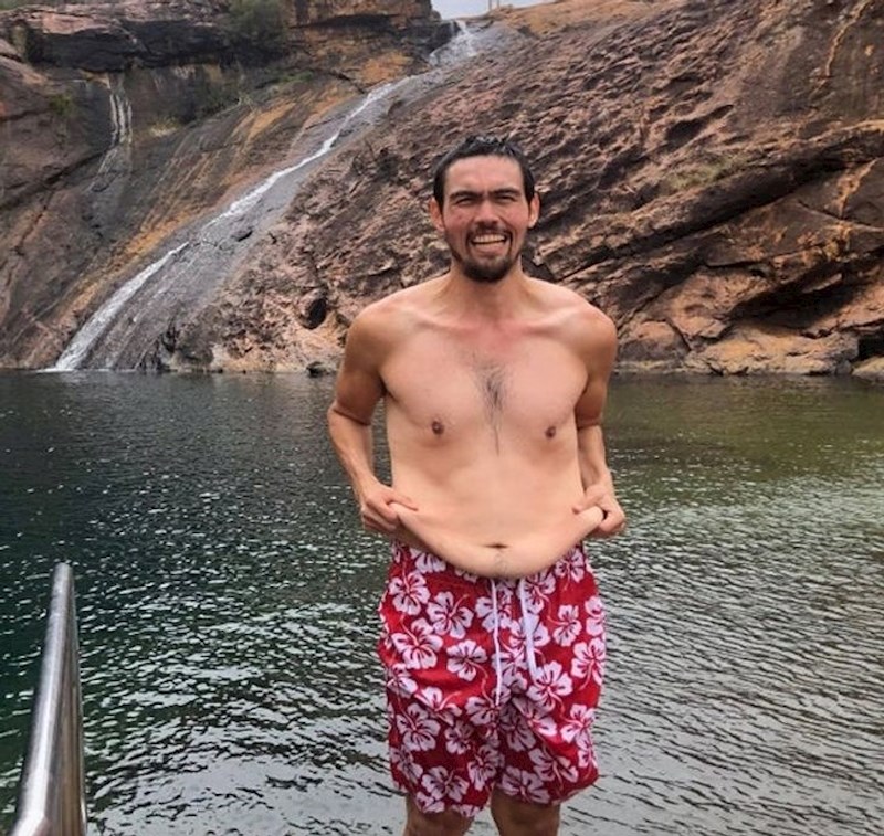 Nakon velikog gubitka kilaže sramio sam se ići na plažu zbog viška kože. Danas sam odlučio da me to više neće sputavati ni u čemu!