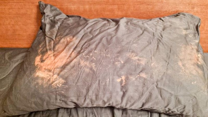 Nikada ne idite na spavanje s kremom za akne koja se nije dovoljno upila