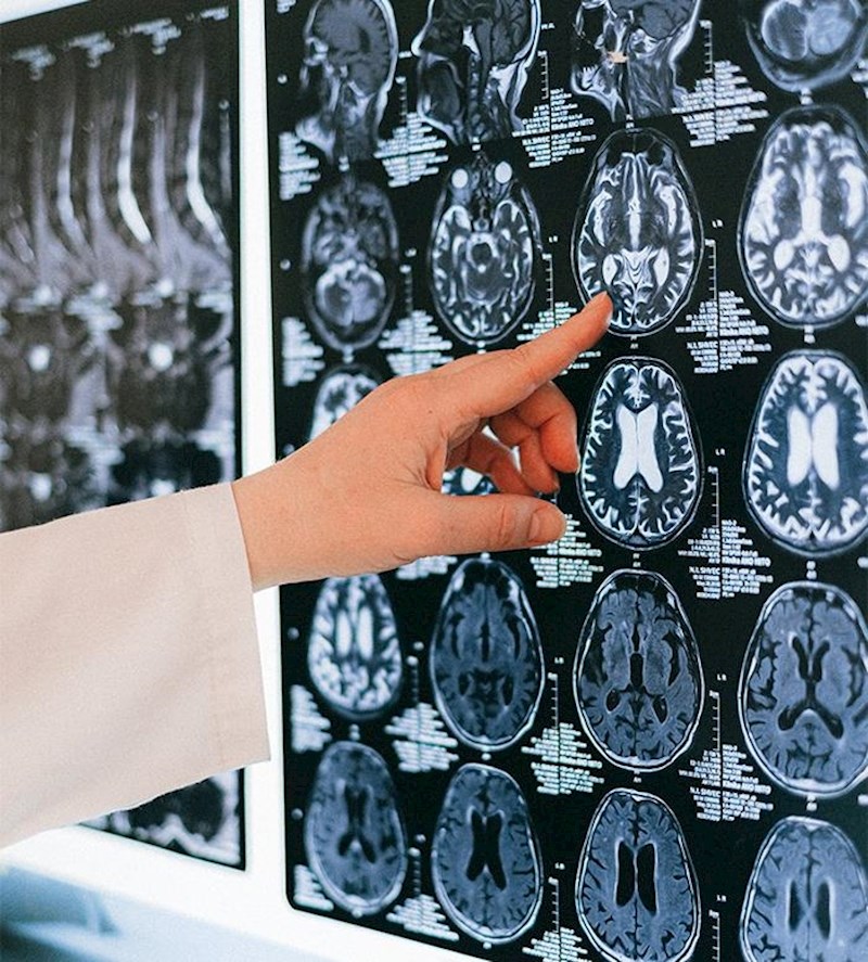 Mozak čini 2% tjelesne težine, ali troši 20% kalorija koje unesemo